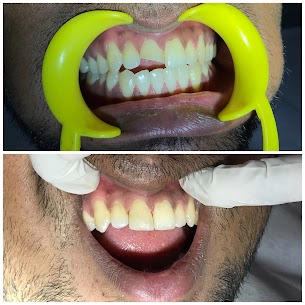 Emergency Composite Repair