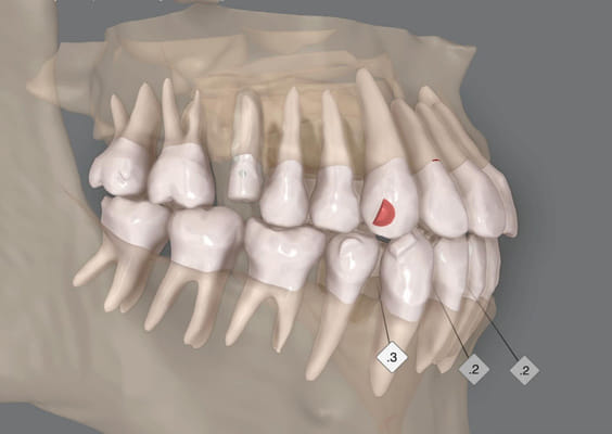 Digital Scanning